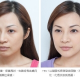 失去的美貌，為什麼要找回來？